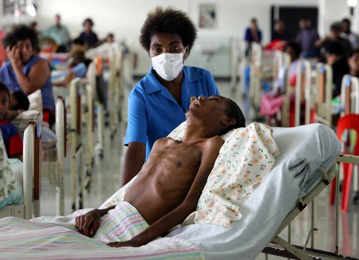 Persons Living with HIV/AIDS